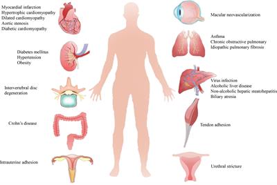 Extracellular vesicles as advanced therapeutics for the resolution of organ fibrosis: Current progress and future perspectives